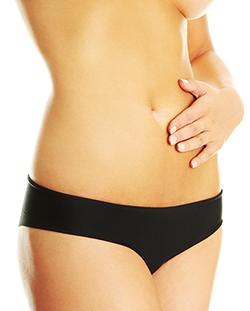 Tummy Tuck in Seattle, Bellevue, Kirkland