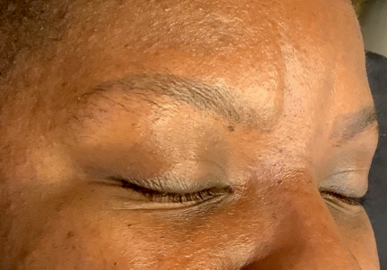 A Before Photo of Microblading In Bellevue and Kirkland