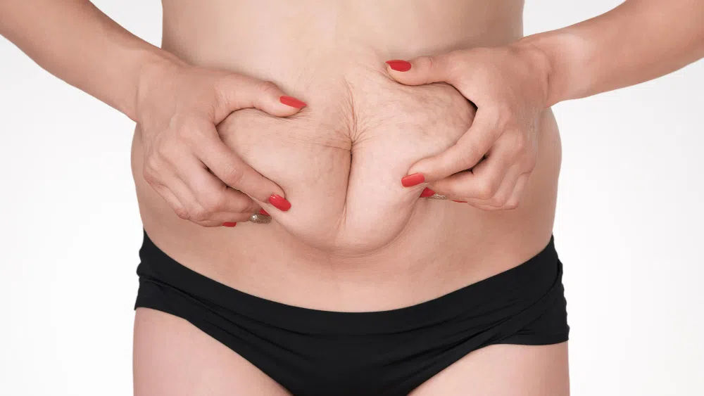 How Can a Tummy Tuck in Kirkland Transform Your Body Shape?