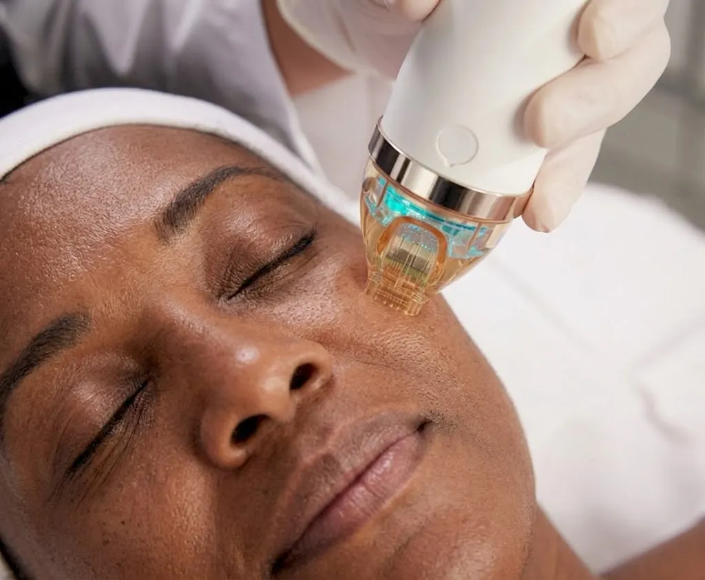 What Areas are Treated with Cutera Secret RF?