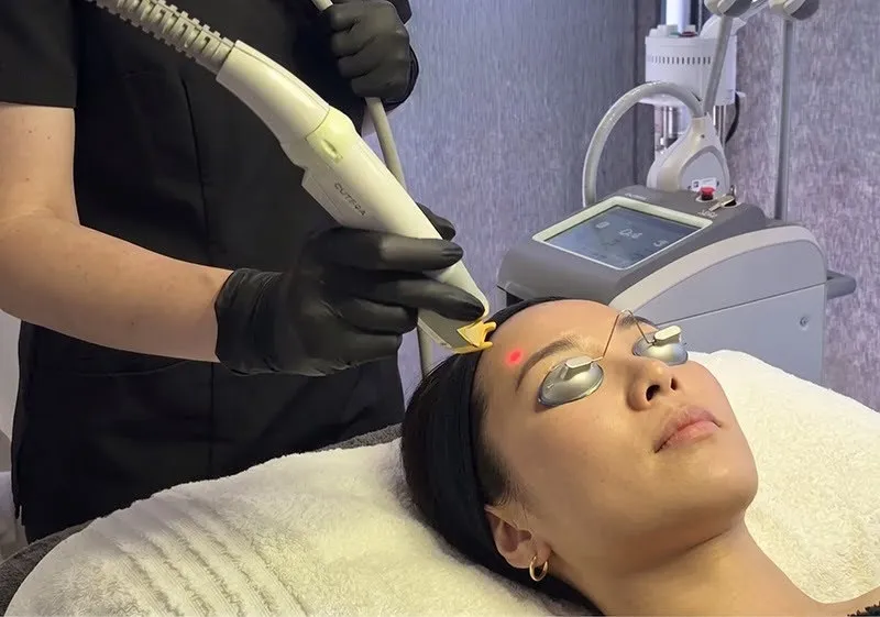 What Is Limelight IPL by Cutera XEO?