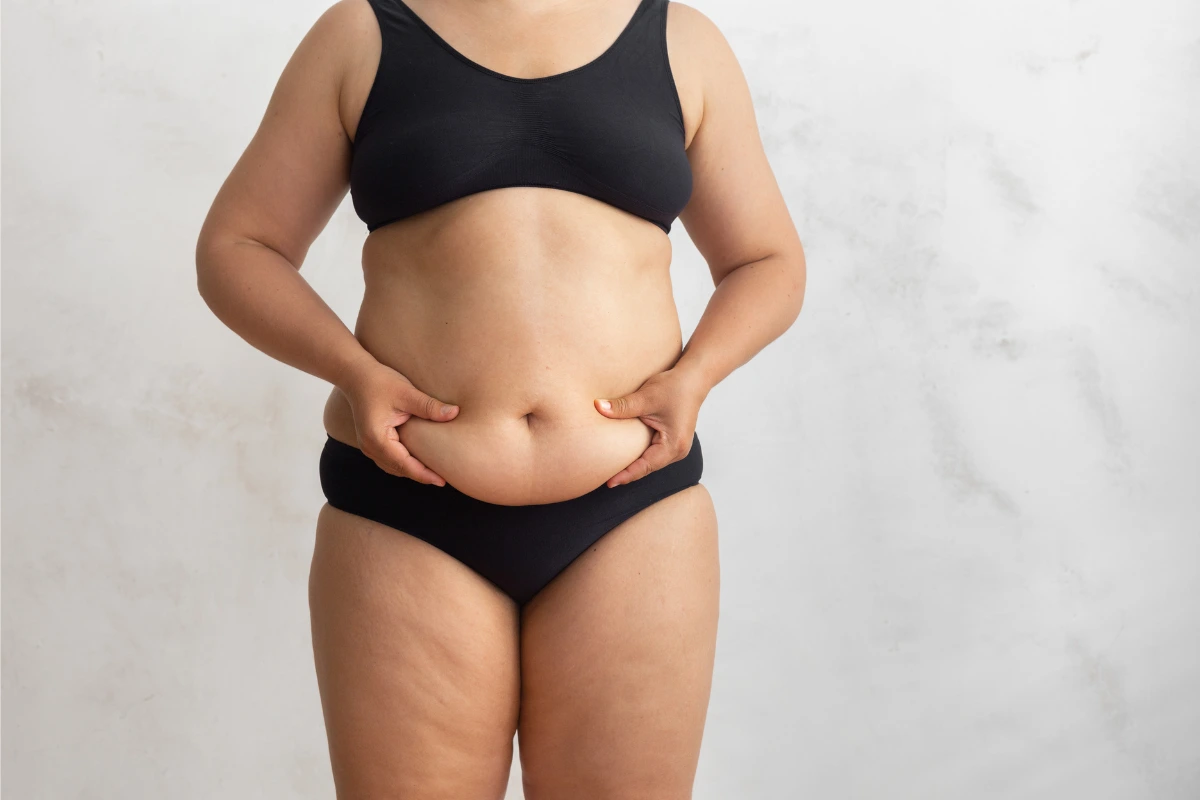 Is a Tummy Tuck Worth It After Having Kids